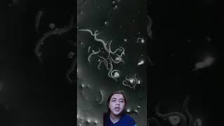 Download lagu banyak cacing dalam kotoran kuku manusia #eksperimen #cacingpita mp3