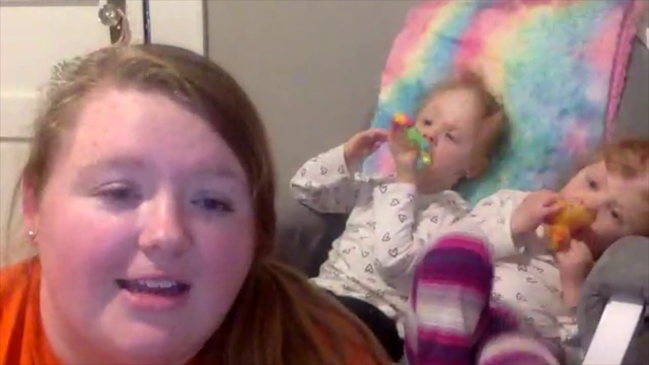 Abby & Erin Delaney were conjoined at the head