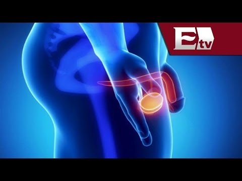 Bewegungstherapie für Prostatakrebs Prostatitis und Mitglied