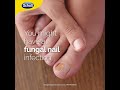 Scholl Fungal Nail Treament