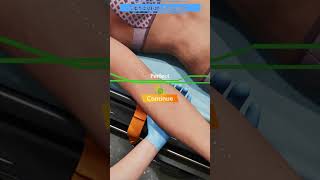 Ambulance Life: A Paramedic Simulator | Gameplay Feature | Vascular Access