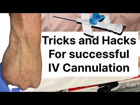IV Cannulation Made Simple: Tricks for Hard-to-Find Veins ! 