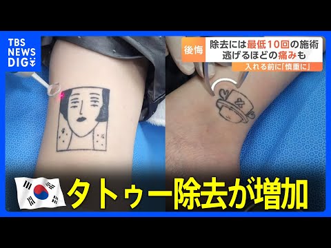 ロノン・デックスについて詳しく解説