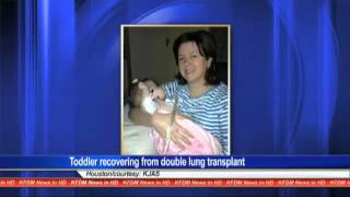 Jasper County baby doing well following lung transplant