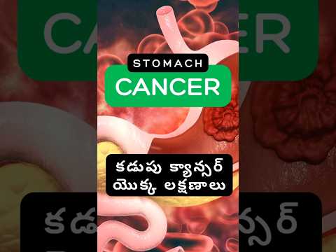 STOMACH CANCER SYMPTOMS TELUGU #stomachcancer #shorts #viral