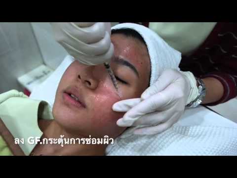 สิ่งที่เพิ่มขึ้น Pynzar เต้านม ผมอายุ 12 ปี แต่ฉันมีหน้าอกเล็ก