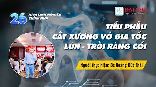 Tiểu phẫu - Cắt xương vỏ gia tốc lún - trồi răng cối. Người thực hiện Bs Hoàng Đức Thái. #niengrang