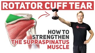 Rotator Cuff Tear (How to Strengthen Supraspinatus)