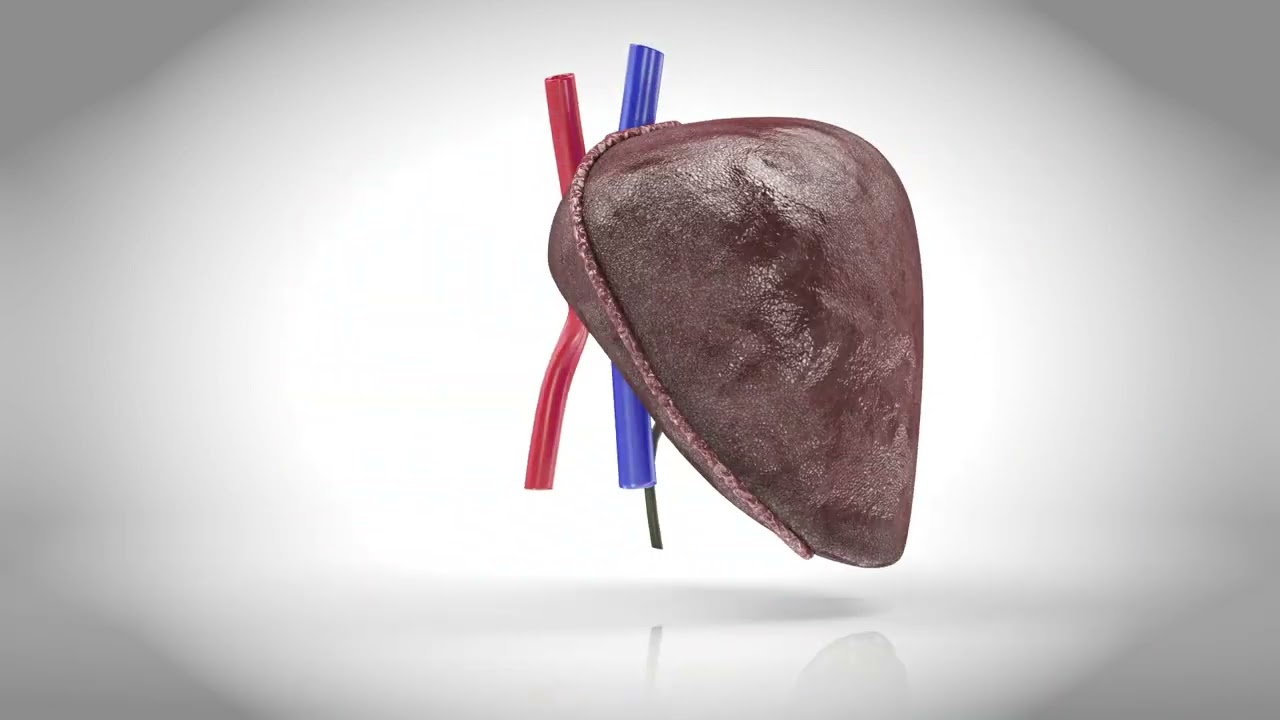 Fatty Liver Steatosis 3D Model