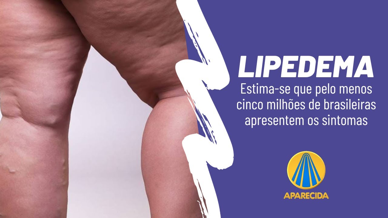 Fabiano Elisei Serra-29