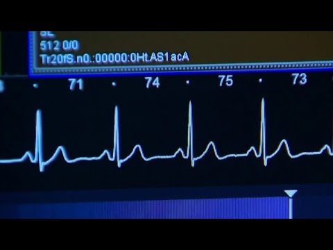 Beaumont Health screening first responders to prevent heart attacks