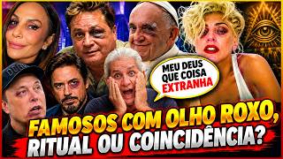 FAMOSOS DO CLUBE DO OLHO ROXO, VERDADE OU MENTIRA?