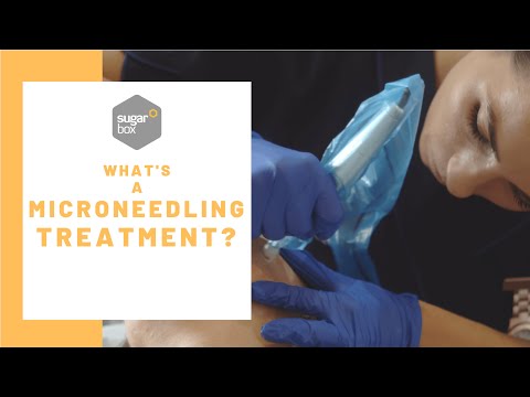 What is microneedling?