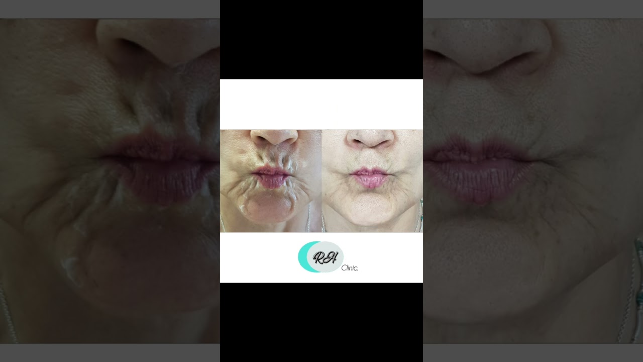 Rosalba Herrero Zerpa-634