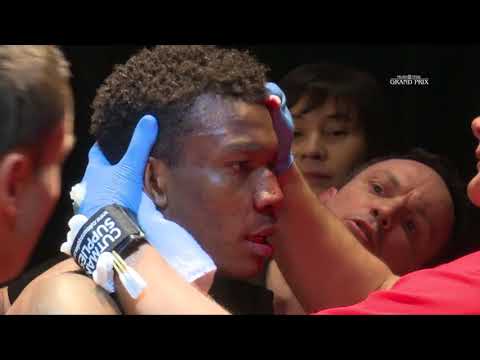 Eddie Abasolo v Jersey Pinto MTGP presents LF39