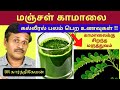 மஞ்சள் காமாலையால் பாதிக்கப்பட்ட கல்�