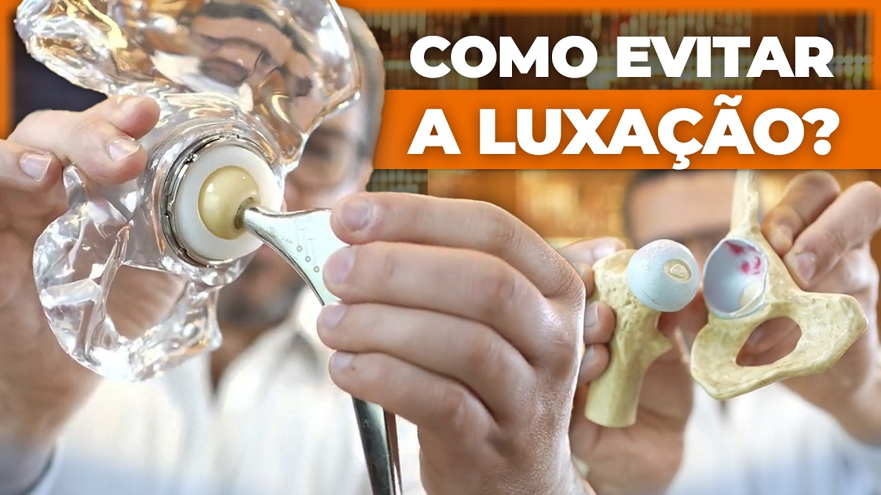 Como EVITAR o deslocamento da prótese de quadril? Risco luxação da prótese de quadril | Dr. Gusmão