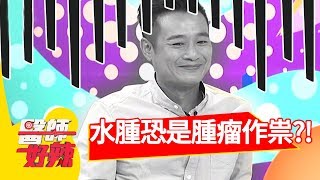 <a href='/search/tags/水腫/' target='_blank'>水腫</a>問題別輕忽，恐是癌症腫瘤作祟？！醫師好辣 2018.06.11 part3 EP550 江坤俊 朱芯儀