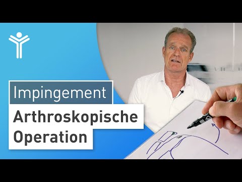 Surgery for shoulder impingement syndrome: What to expect and what the surgery brings