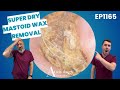 Extreme Dry Skin Ear Wax In Mastoid Cavity Cleared EP1165