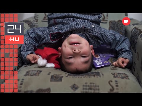 Videó gyermekek férgeiről, Trichocephalosis felnőttek tünetei és kezelése