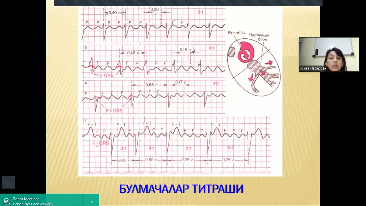 Yurak ritmining buzilishi va blokadalar