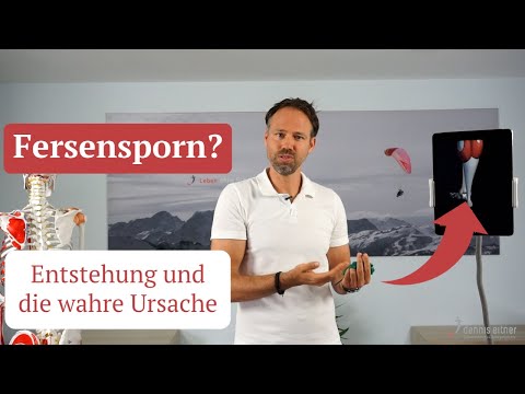 Fersensporn erklärt - Wie er entsteht und wie du ihn ursächlich behandelst