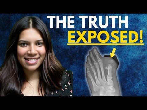 Can You Walk Without Toes? (The Truth Revealed!)