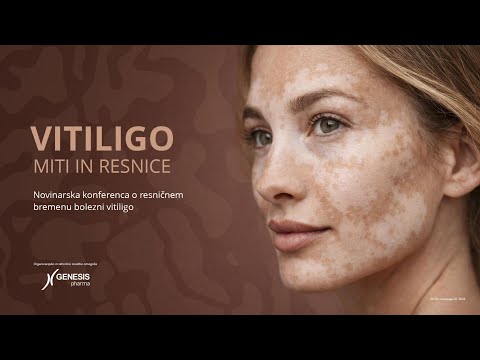 Novinarska konferenca o bolezni vitiligo