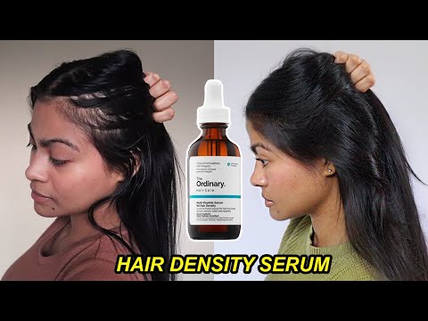 I tried The Ordinary Hair Density Serum for 1 YEAR &...