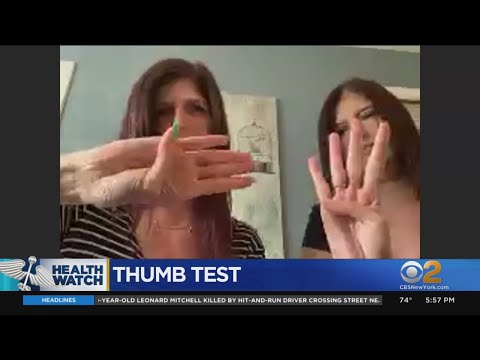 Simple Thumb-Palm Test May Help Detect Likelihood Of Aneurysm