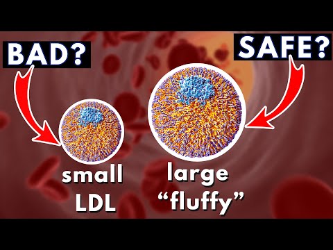 LDL size and Heart Disease (small dense vs large "fluffy") | Dr. William Cromwell