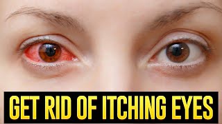 ITCHY EYES TREATMENT: How To Get Rid Of Itching Eyes With These 3 Simple Tricks