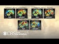 Can fMRI brain scans spot suicidal thoughts?