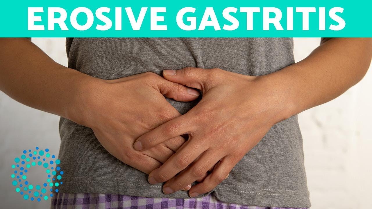 EROSIVE GASTRITIS - Belly Pain And Vomiting