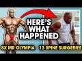 Ronnie Coleman: Mr. 8x Olympia to 13 Spine Sugeries. Here's what happened...