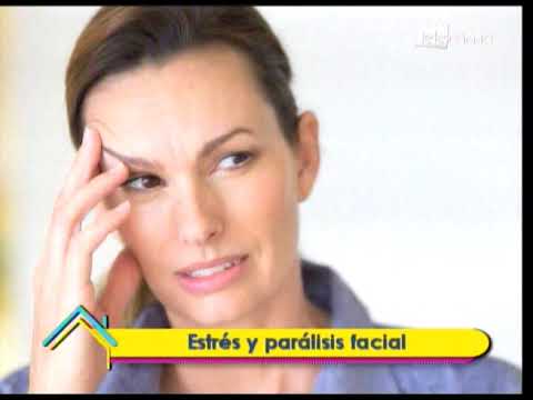 Estrés y parálisis facial