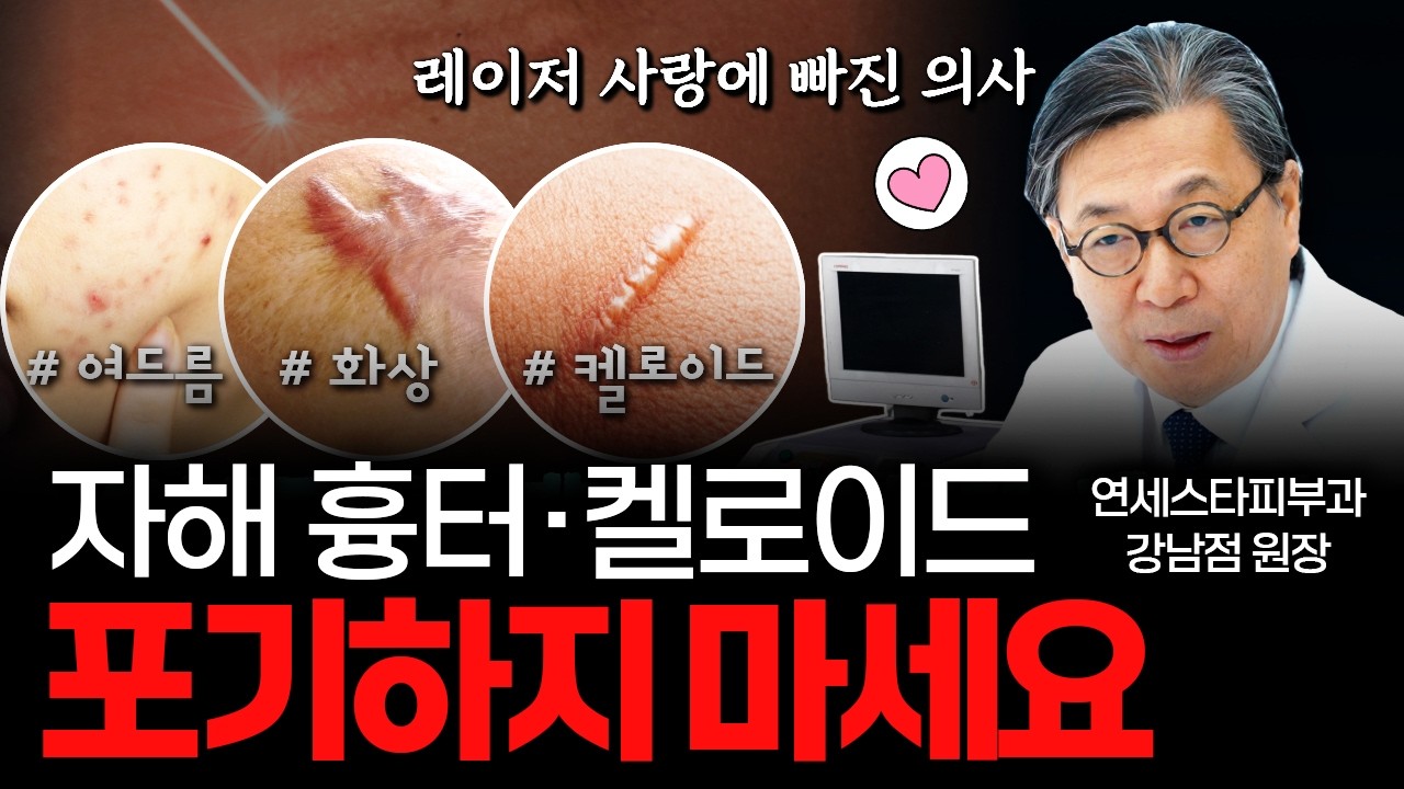 오래된 흉터 치료, 늦었다고 생각할 때가 가장 빠른 이유 [김영구 연세스타피부과 강남점 대표원장]