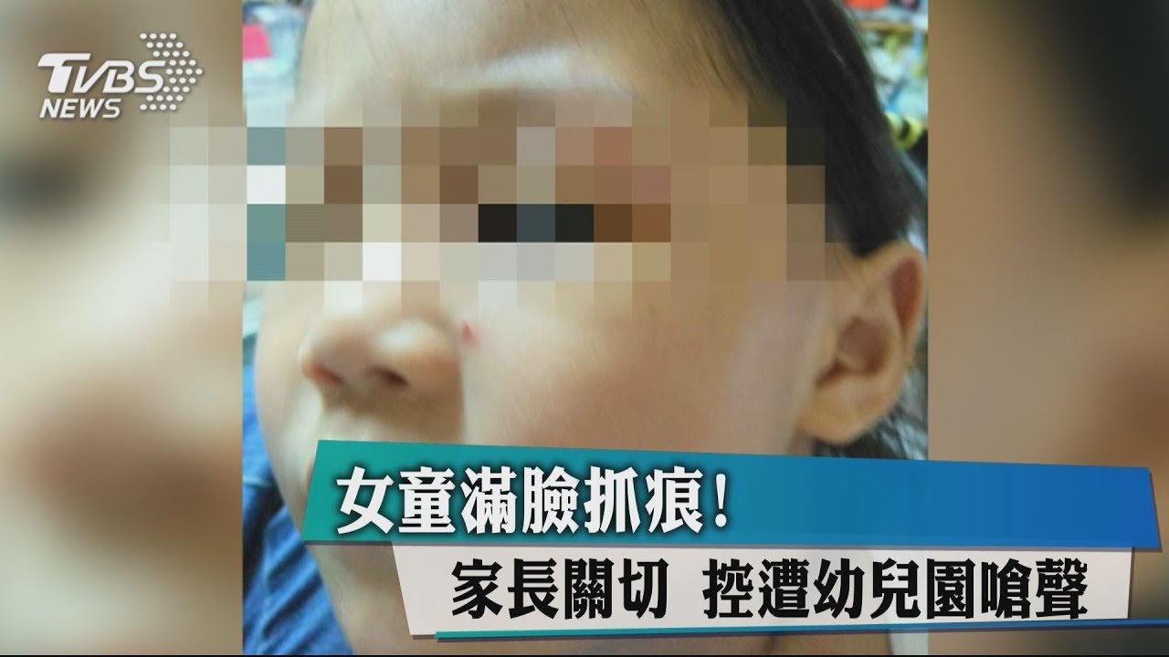 女童滿臉抓痕！家長關切　控遭幼兒園嗆聲