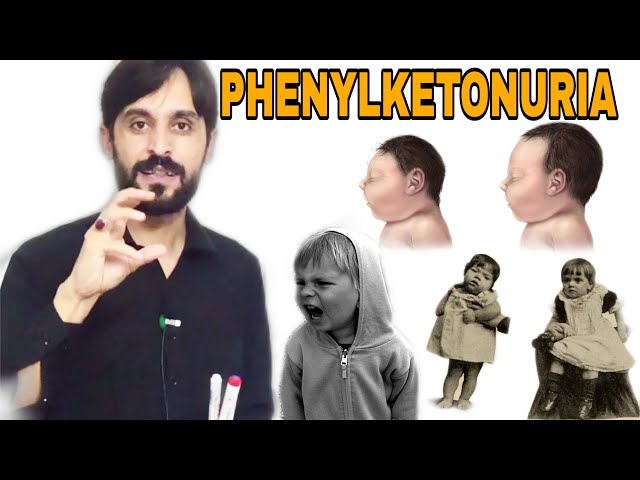 Video Aussprache von phenylketonuria in Englisch Video Aussprache von phenylketonuria in Englisch