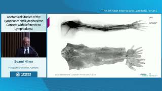 Anatomical Studies of the Lymphatics and Lymphosome Concept with Reference to Lymphedema 썸네일