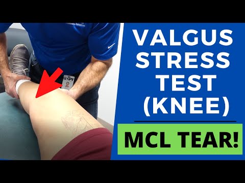 Modified Lachman s Test On a patient with a COMPLETE ACL TEAR