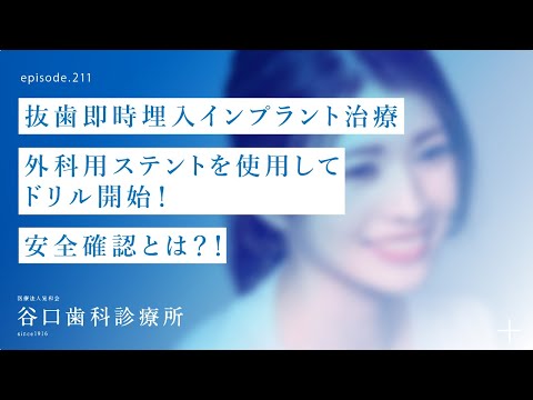 第211話 4S抜歯即時埋入インプラント治療-外科用ステント・ドリル開始‼️-安全確認とは⁉️