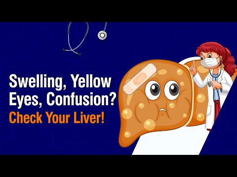 Swelling, Yellow Eyes, Confusion? Check Your Liver! | Dr. Pardhasaradhi P