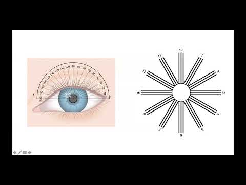 Hogyan lehet kialakítani az erős látást