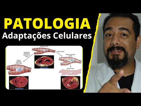Cellular Adaptation to Harmful Stimuli (Stress) | Reversible Injury | Necrosis | Pathology