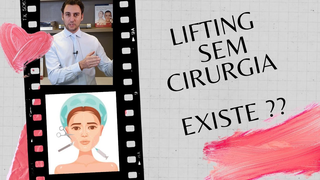 Facelift sem cirurgia, é possivel  Soft Lyft: lifting com preenchimentos a base de  a. Hialurônico