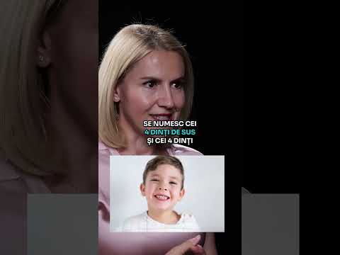 Cauzele înghesuirii dentare și ce poți face