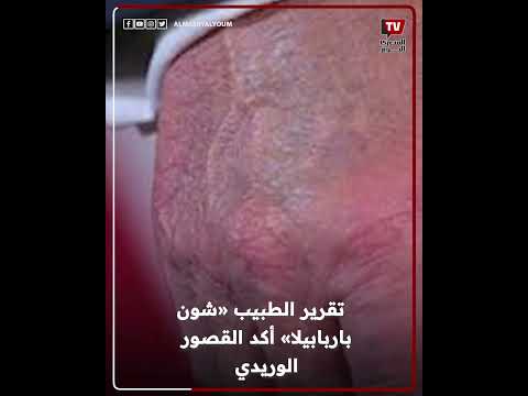 تفاصيل الحالة الصحية لـ دونالد ترامب