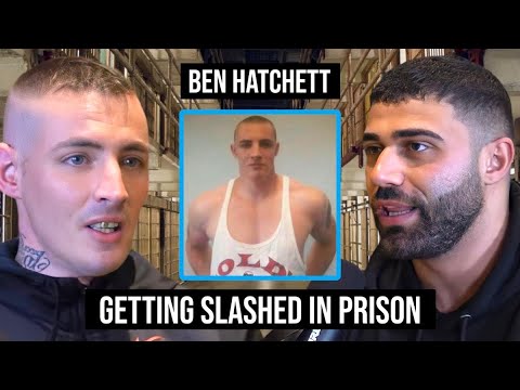 HOW I SURVIVED GETTING STABBED IN PRISON!